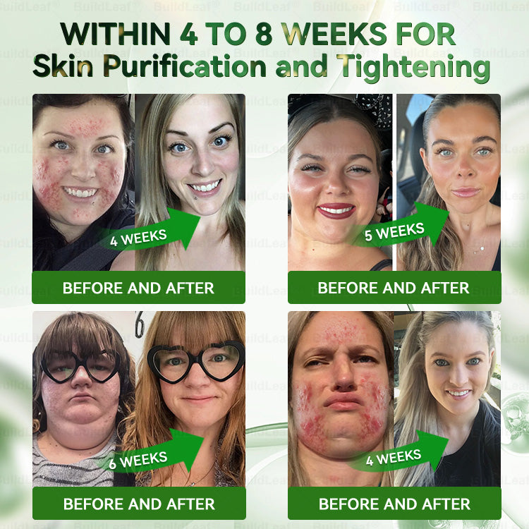 Official Store | BuildLeaf® 🧑‍⚕️ GLP–1 EIGHT IN–ONE Health Solution Oral Liquid (Just one dose a day — visible results in just 7 days) ✅ For obesity, cardiovascular health, diabetes, sleep apnea, joint issues, and more