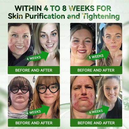 Official Store | BuildLeaf® 🧑‍⚕️ GLP–1 EIGHT IN–ONE Health Solution Oral Liquid (Just one dose a day — visible results in just 7 days) ✅ For obesity, cardiovascular health, diabetes, sleep apnea, joint issues, and more