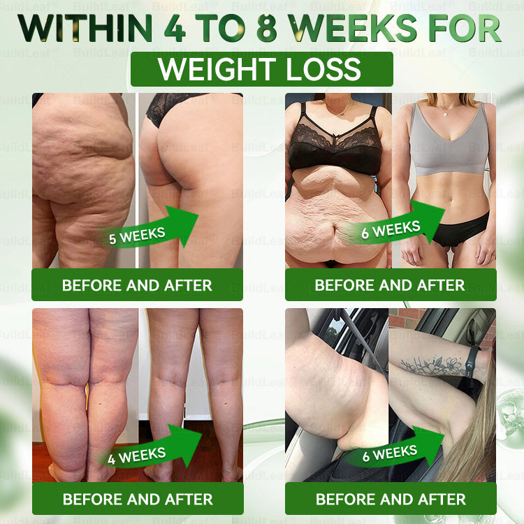 Official Store | BuildLeaf® 🧑‍⚕️ GLP–1 EIGHT IN–ONE Health Solution Oral Liquid (Just one dose a day — visible results in just 7 days) ✅ For obesity, cardiovascular health, diabetes, sleep apnea, joint issues, and more